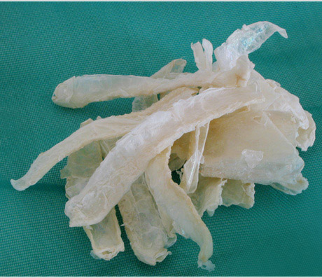 Chitosan